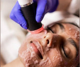 Oxygen CO₂ Facial Pen