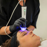 Oxygen CO₂ Facial Pen